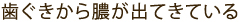 歯ぐきから膿が出てきている