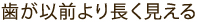 歯が以前より長く見える