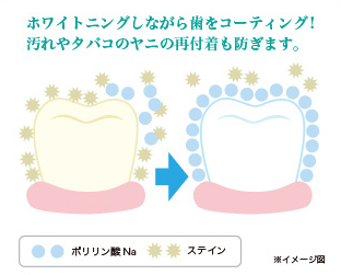 ホワイトニング×予防効果