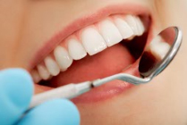 歯石や歯垢を除去